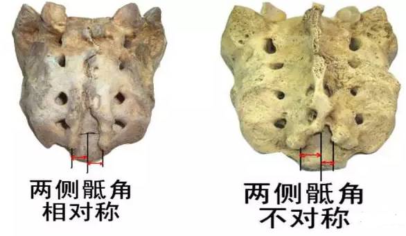 骶骨的重要性